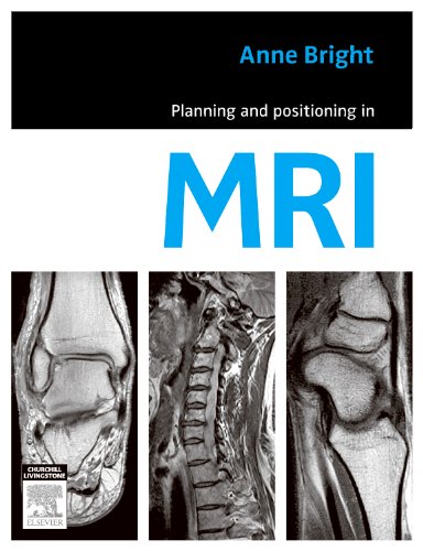 9780729539852: Planning and Positioning in MRI, 1e