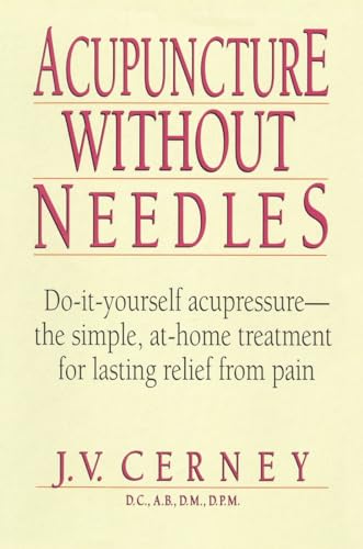 9780735200357: Acupuncture Without Needles