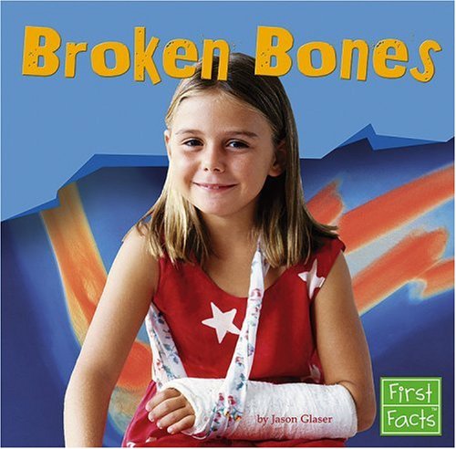 Broken Bones (First Facts) (9780736863308) by Glaser, Jason