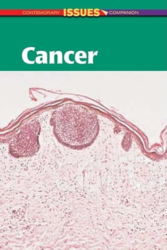 9780737724448: Cancer (Contemporary Issues Companion (Hardcover))