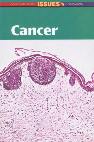 9780737724455: Cancer (Contemporary Issues Companion (Paperback))