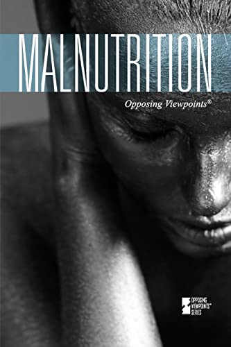 Beispielbild fr Malnutrition zum Verkauf von Better World Books