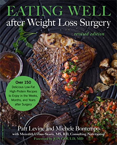 Beispielbild fr Eating Well after Weight Loss Surgery: Over 150 Delicious Low-Fat High-Protein Recipes to Enjoy in the Weeks, Months, and Years after Surgery zum Verkauf von SecondSale
