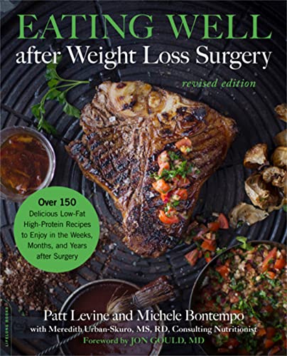 Stock image for Eating Well After Weight Loss Surgery: Over 150 Delicious Low-fat High-protein Recipes to Enjoy in the Weeks, Months, and Years After Surgery for sale by Revaluation Books