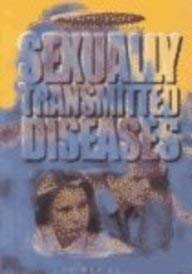 Imagen de archivo de Sexually Transmitted Diseases a la venta por Better World Books
