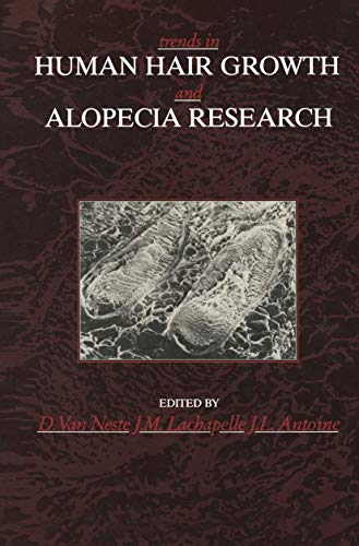 Stock image for Trends in Human Hair Growth and Alopecia Research for sale by Zubal-Books, Since 1961