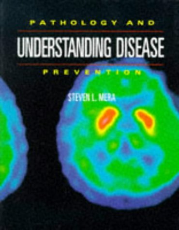 Stock image for Understanding Disease: Pathology and Prevention for sale by WorldofBooks
