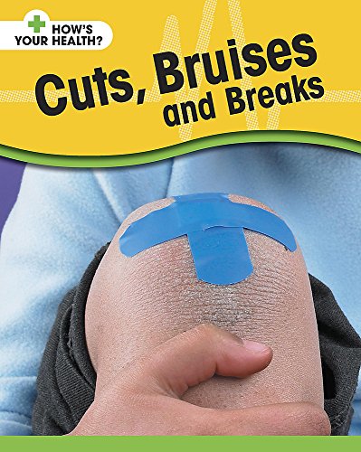 Cuts, Bruises and Breaks (How's Your Health?) (9780749666712) by Angela Royston