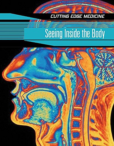Cutting Edge Medicine: Seeing Inside The Body (9780749669744) by Carol Ballard