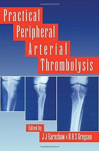 Stock image for Practical Peripheral Arterial Thrombolysis for sale by Anybook.com