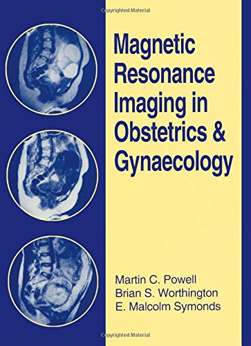 Imagen de archivo de Magnetic Resonance Imaging in Obstetrics and Gynecology a la venta por HPB-Red