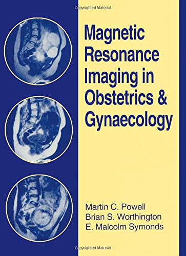Stock image for Magnetic Resonance Imaging in Obstetrics and Gynecology for sale by HPB-Red