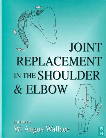 Stock image for Joint Replacement in the Shoulder and Elbow for sale by Better World Books Ltd