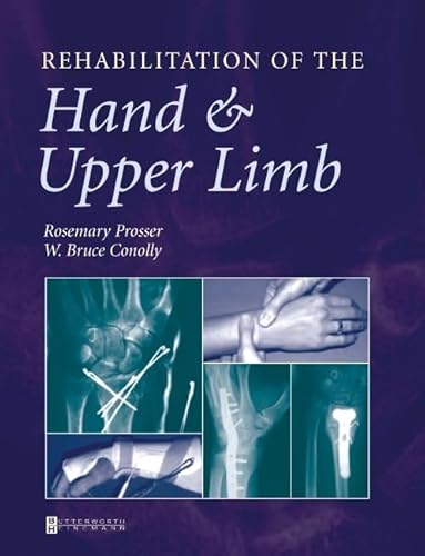 Imagen de archivo de Rehabilitation of the Hand and Upper Limb a la venta por St Vincent de Paul of Lane County