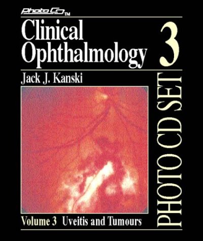 9780750626958: Uveitis and Tumours: v.3