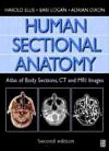 Human Sectional Anatomy: Atlas Of Body Sections, CT and MRI Images (9780750633673) by Ellis, Harold; Logan, Bari M.; Dixon, Adrian K.