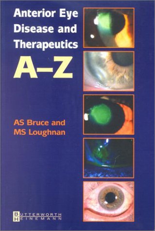 Stock image for Anterior Eye Disease and Therapeutics A-Z for sale by WorldofBooks