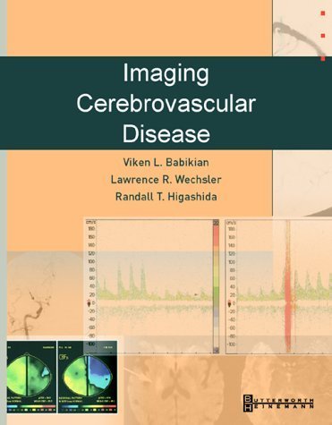 Stock image for Imaging Cerebrovascular Disease for sale by Wonder Book