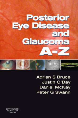 Imagen de archivo de Posterior Eye Disease and Glaucoma A-Z a la venta por NEWBOOKSHOP