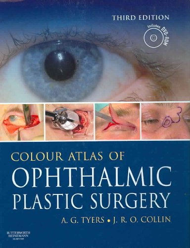 Stock image for Colour Atlas of Ophthalmic Plastic Surgery with DVD for sale by Krak Dogz Distributions LLC