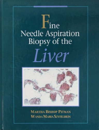 Imagen de archivo de Fine Needle Aspiration Biopsy of the Liver a la venta por COLLINS BOOKS