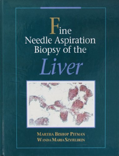 Fine Needle Aspiration Biopsy of the Liver, A Color Atlas