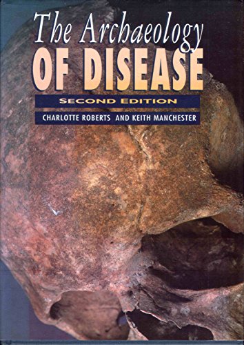Stock image for The Archaeology of Disease (Archaeology S.) for sale by WorldofBooks