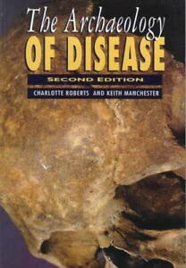 Beispielbild fr The Archaeology of Disease zum Verkauf von Reuseabook