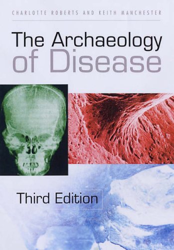 9780750926836: The Archaeology of Disease