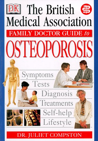 Imagen de archivo de BMA Family Doctor: Osteoporosis a la venta por WorldofBooks