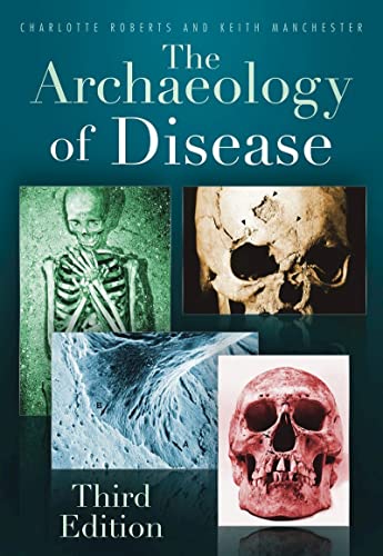 9780752457505: The Archaeology of Disease [Lingua inglese]: Third Edition