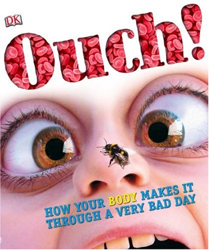 Stock image for Ouch! for sale by Better World Books