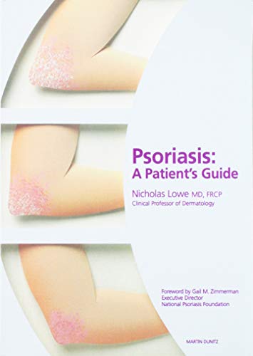 Beispielbild fr Psoriasis: A Patient's Guide zum Verkauf von Cheryl's Books