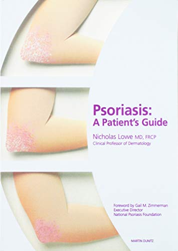 Imagen de archivo de Psoriasis: A Patient's Guide a la venta por Cheryl's Books