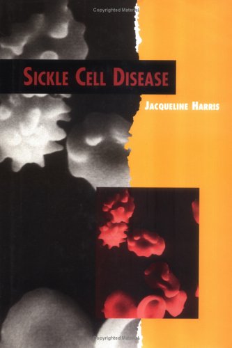 Imagen de archivo de Sickle Cell Disease (Twenty-First Century Medical Library) a la venta por The Book Cellar, LLC