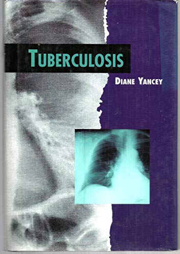 Stock image for Tuberculosis for sale by Better World Books: West