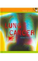 9780761418023: Lung Cancer (Health Alert)