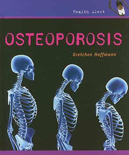 Beispielbild fr Osteoporosis zum Verkauf von Better World Books