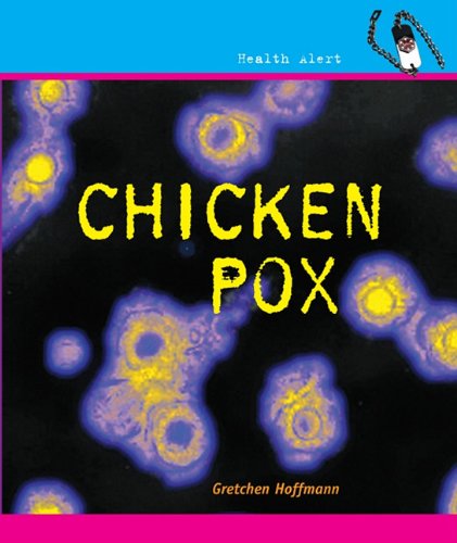 9780761429166: Chickenpox (Health Alert)