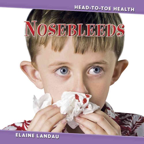 Nosebleeds (Head-To-Toe Health) (9780761435037) by Landau, Elaine