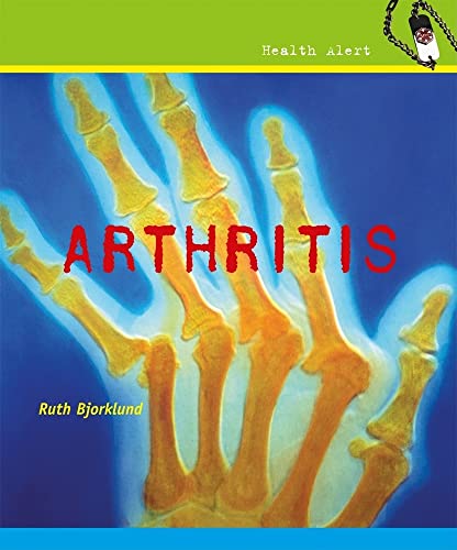 9780761439844: Arthritis (Health Alert)