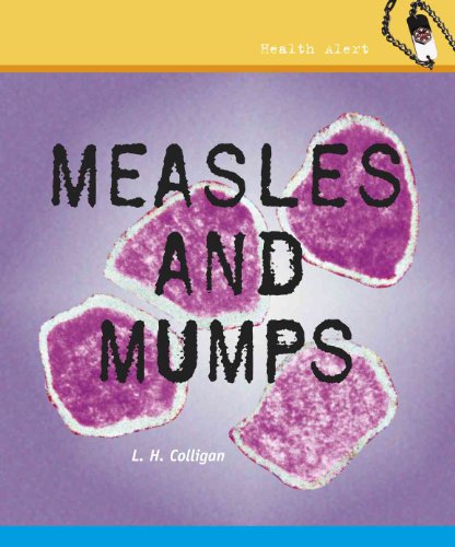 Beispielbild fr Measles and Mumps (Health Alert) zum Verkauf von Wonder Book