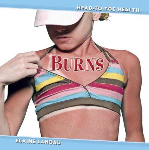 Stock image for Burns for sale by Better World Books