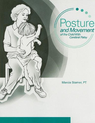 9780761649007: Posture and Movement of the Child With Cerebral Palsy