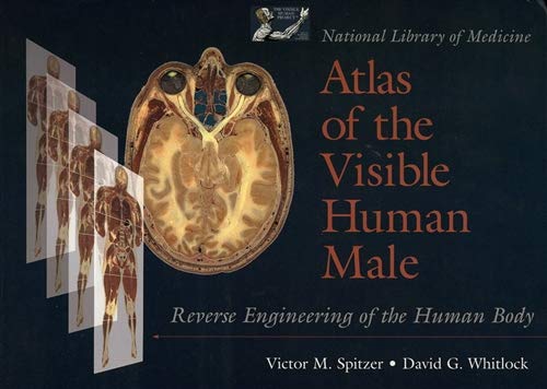 Atlas of the Visible Human Male: Reverse Engineering of the Human Body