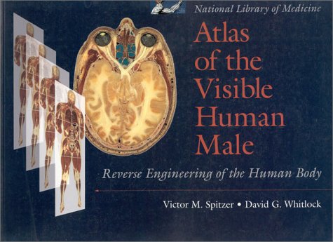 9780763703479: National Library of Medicine Atlas of the Visible Human Male: Reverse Engineering of the Human Body