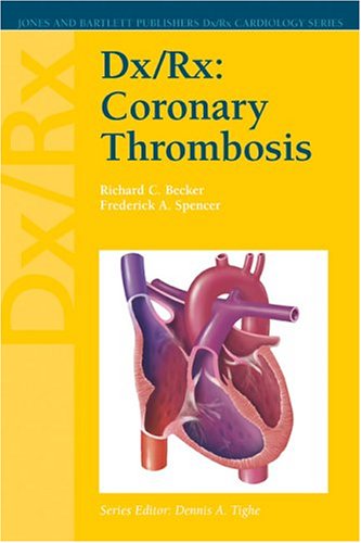 9780763724801: Dx/Rx: Coronary Thrombosis (Dx/Rx Cardiology Series)
