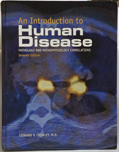 Imagen de archivo de An Introduction to Human Disease (Introduction to Human Disease: Pathology and Pathophysiology Correlations) a la venta por HPB-Red