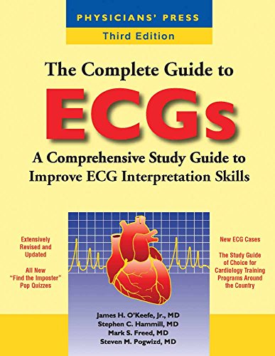 Stock image for The Complete Guide to Ecgs for sale by ThriftBooks-Dallas