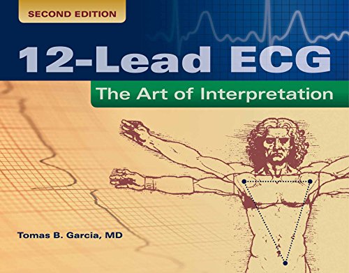9780763773519: 12-Lead ECG: The Art of Interpretation